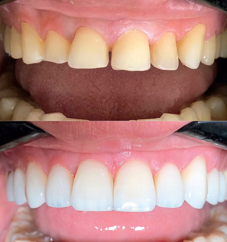 Reabilitação oral estética – foto 1